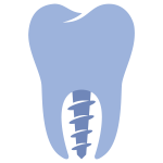Implantes Dentales Precios