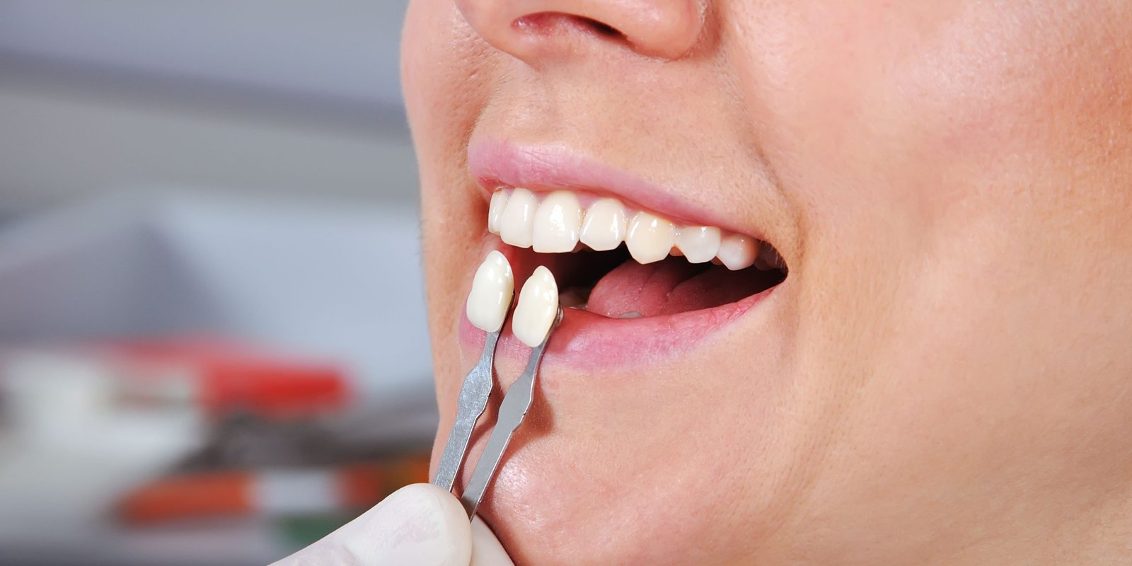 Estética Dental Escazú
